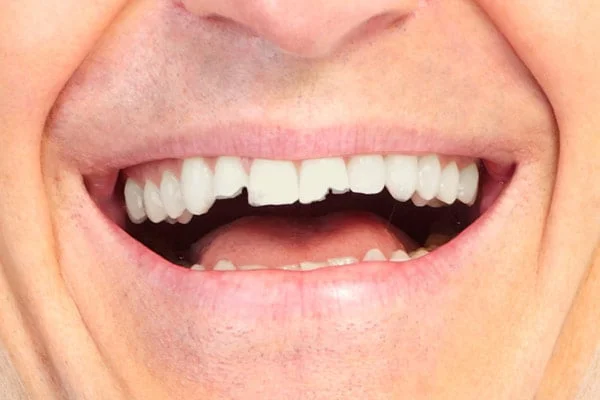 s001-1 Looks Wow Dental Clinic in Bankstown