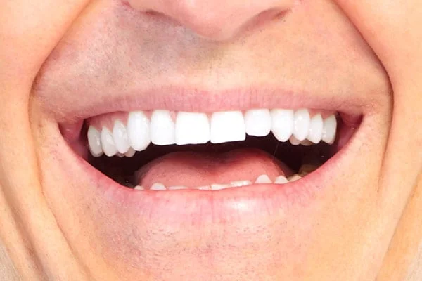 s001 Looks Wow Dental Clinic in Bankstown