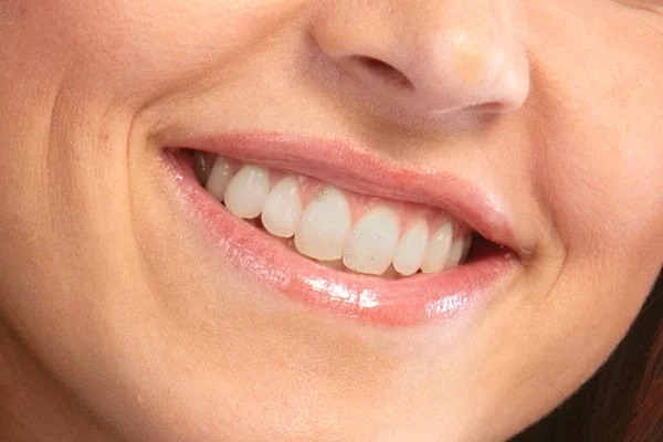 s002-1 Looks Wow Dental Clinic in Bankstown