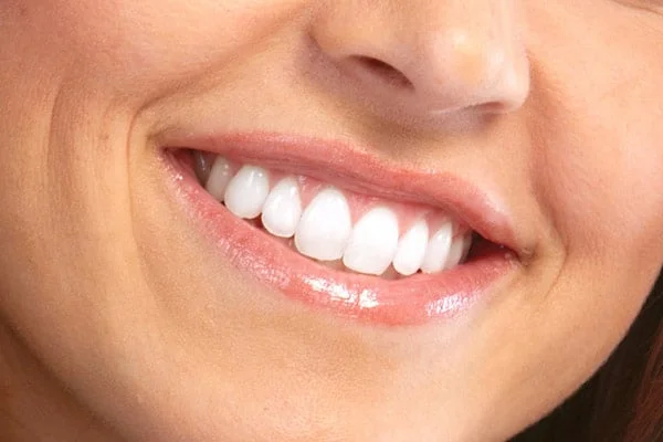 s002 Looks Wow Dental Clinic in Bankstown